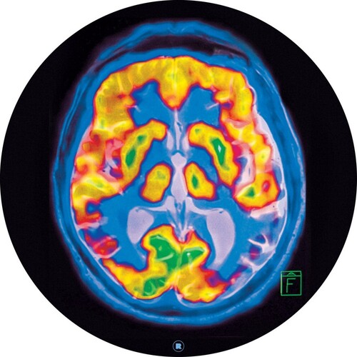 Brainscanby Frankey & Sandrino (Vinyl Record)