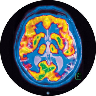 Frankey & Sandrino: Brainscan (12-Inch Single)