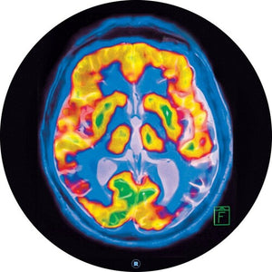 Frankey & Sandrino: Brainscan (12-Inch Single)